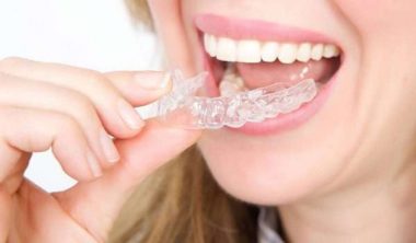 مميزات تقويم الأسنان الشفاف